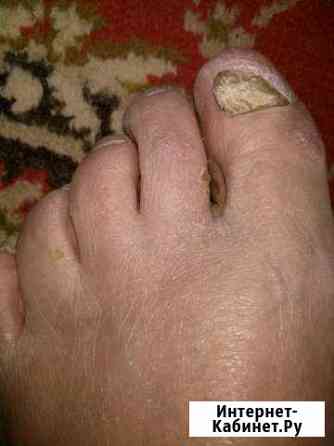 Педикюр с выездом на дом Москва