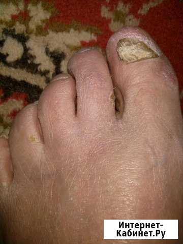 Педикюр с выездом на дом Москва - изображение 1