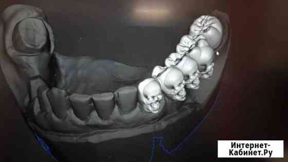 Моделирование зубов 3d Воронеж