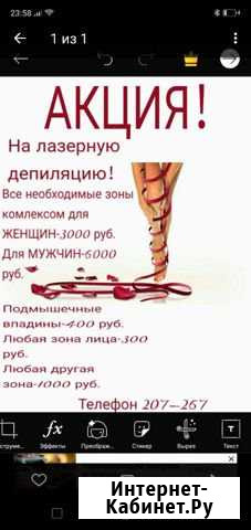 Лазерная эпиляция Мурманск - изображение 1