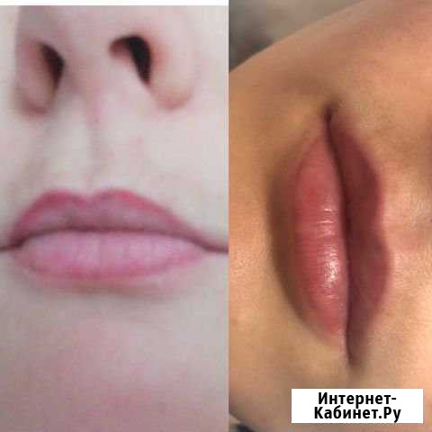 Лазерное удаление тату и татуажа Санкт-Петербург - изображение 1