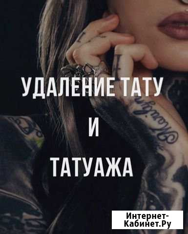 Удаление татуировок, татуажа Казань - изображение 1