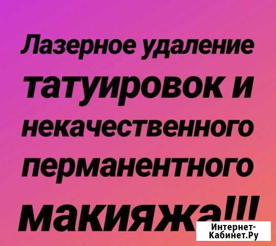 Лазерное удаление татуировок и перманентного макия Биробиджан - изображение 1