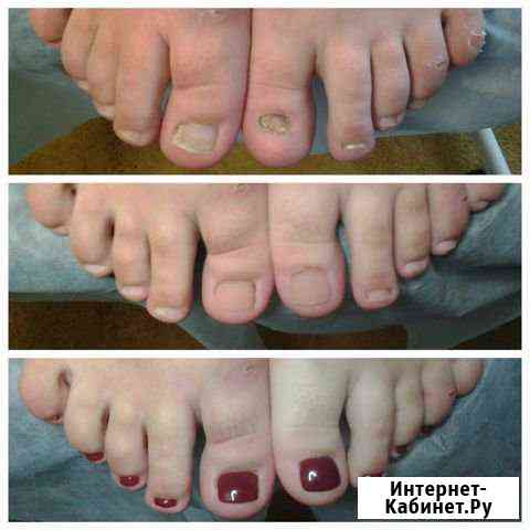 Мастер педикюра и маникюра Тверь