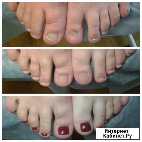 Мастер педикюра и маникюра Тверь - изображение 1