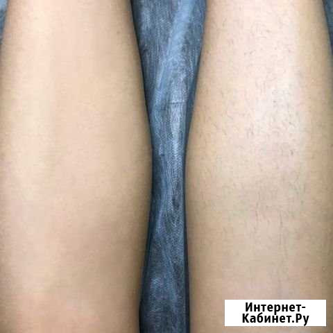 Шугаринг бесплатно Иваново - изображение 1