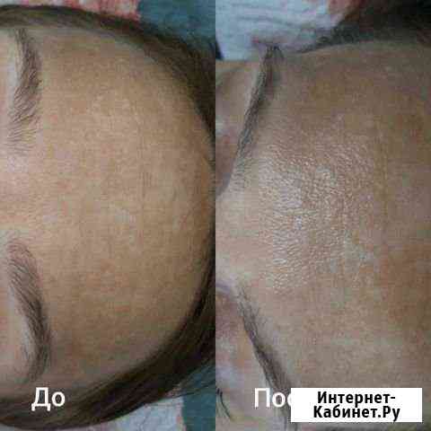SPA уход за коже лица и рук Биробиджан