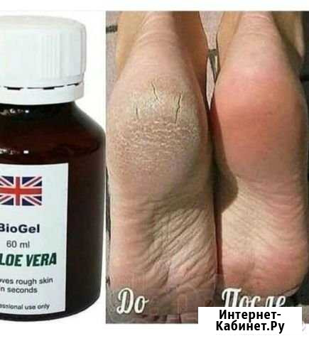 Биогель для педикюра Тамбов - изображение 1