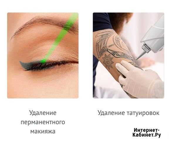 Лазерное удаление татуировок и перманентного макия Первоуральск - изображение 1
