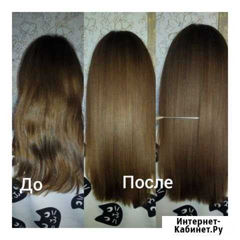 Нанопластика, Ботокс, Биопластика Новокузнецк - изображение 1