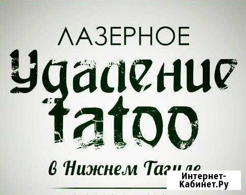 Удаление тату и татуажа Нижний Тагил - изображение 1