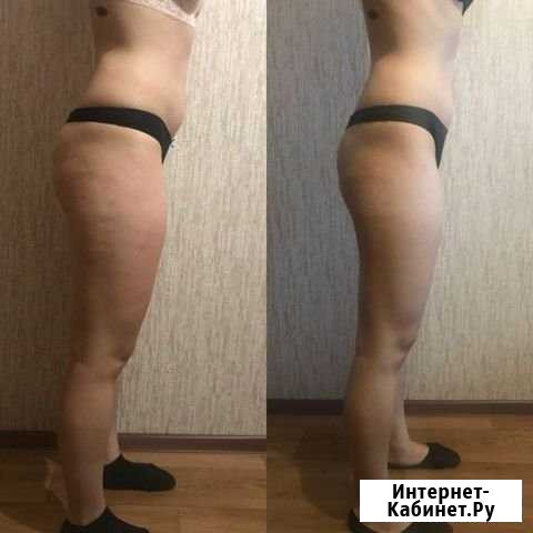 Массаж Антицеллюлитный Тольятти - изображение 1