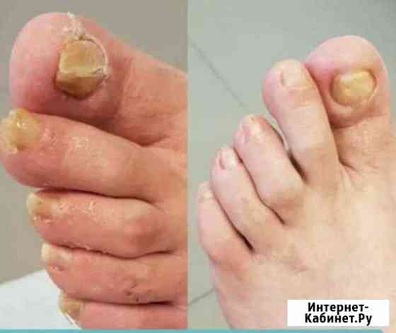 Педикюр пожилым,купание лежачих на дому Москва