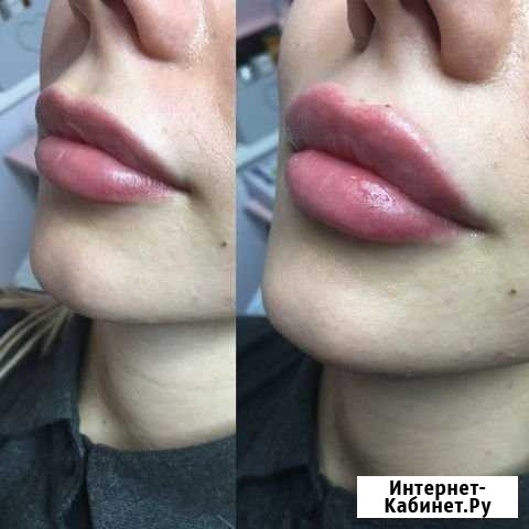 Косметолог Мытищи - изображение 1