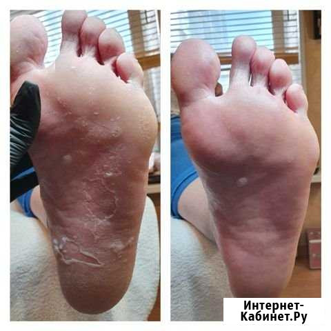 Педикюр, ботокс ресниц, наращивание (клас Санкт-Петербург - изображение 1