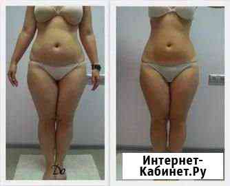 Кавитанция, массаж Новокузнецк