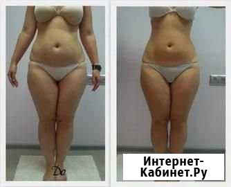 Кавитанция, массаж Новокузнецк - изображение 1