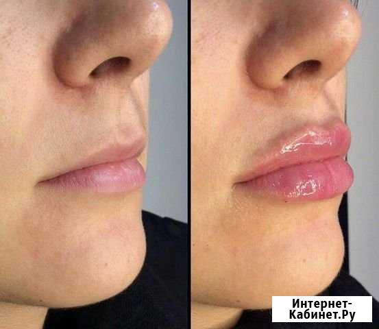Косметология Сочи - изображение 1