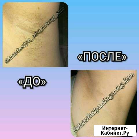 Шугаринг и skins Елизово - изображение 1