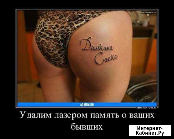 Удаляю неудачные или нежелательные татуировки Таганрог - изображение 1