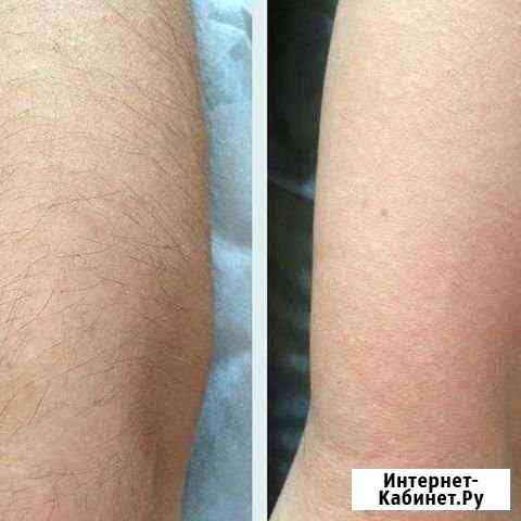 Шугаринг Махачкала