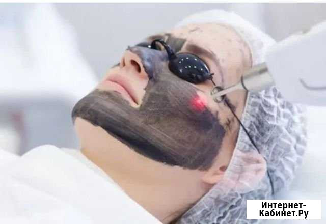 Карбоновый пилинг Петропавловск-Камчатский - изображение 1