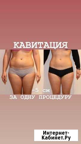 Похудение кавитация массаж Абакан - изображение 1