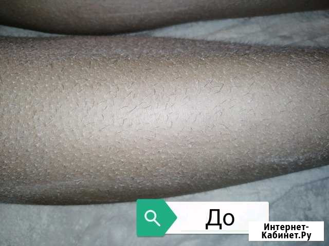 Шугаринг Рязань - изображение 1
