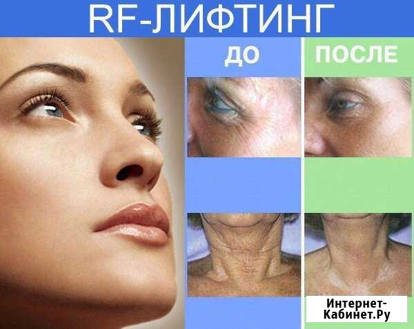 Рф-лифтинг, безоперационная подтяжка лица Курган - изображение 1