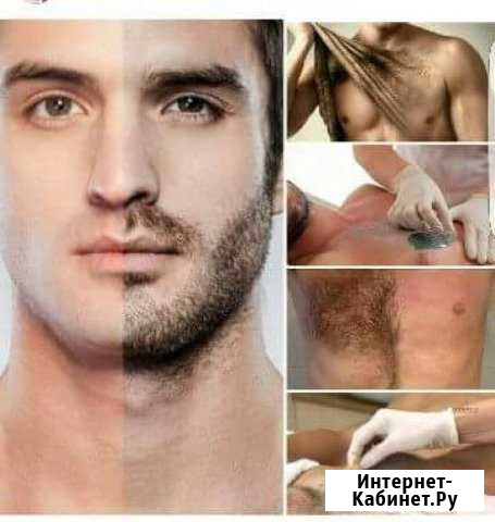 Депиляция Мужская и Женская Ноябрьск - изображение 1