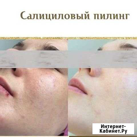 Косметолог эстетист Чебоксары - изображение 1