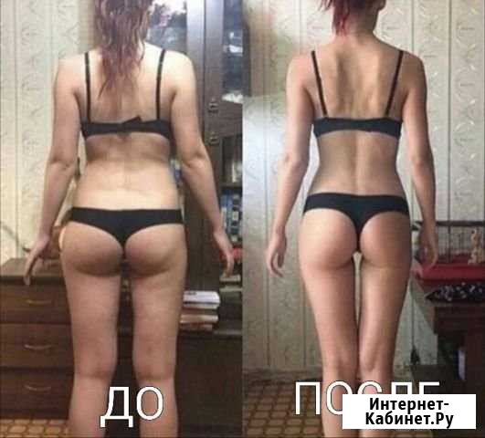 Аппаратный массаж Норильск - изображение 1