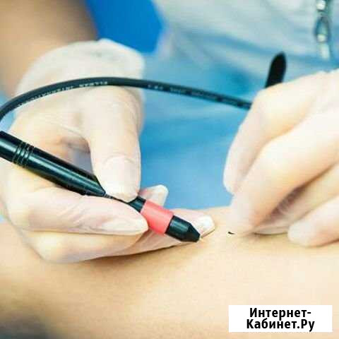 Электроэпиляция Оренбург - изображение 1