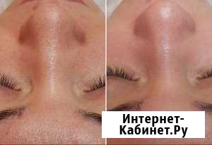 Косметолог Волгодонск - изображение 1