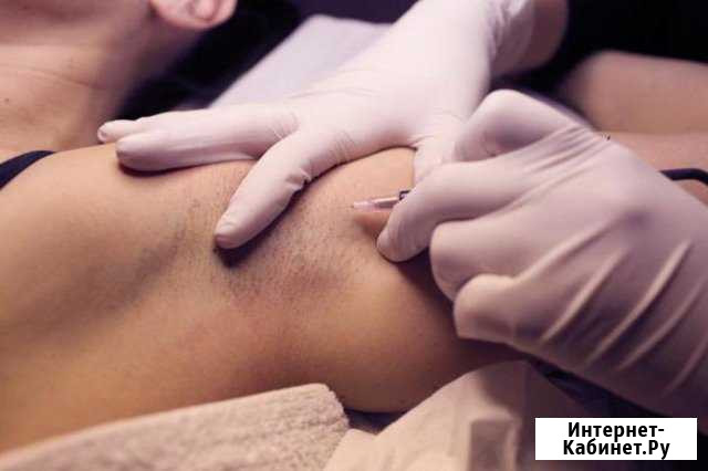 Электроэпиляция жби Екатеринбург - изображение 1