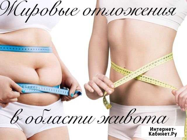 Массаж антицеллюлитный Волгоград - изображение 1