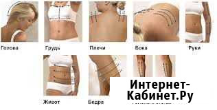 Аппаратная коррекция фигуры Севастополь - изображение 1