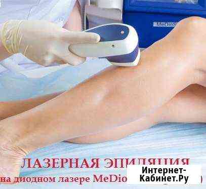 Лазерная эпиляция Иркутск