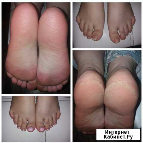 Педикюр/маникюр/наращивание ногтей(возможен выезд) Санкт-Петербург - изображение 1