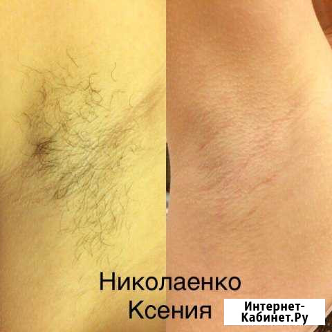 Шугаринг.ламинирование ресниц Мурино - изображение 1