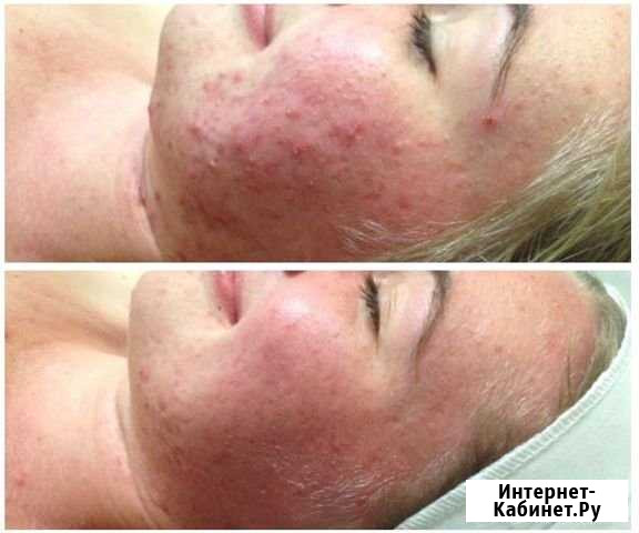 Косметолог Липецк - изображение 1