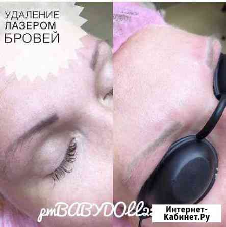 Удаление татуировок Павловский Посад