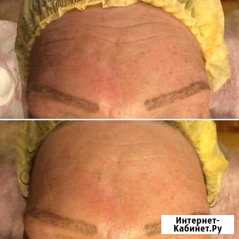Скульптурный массаж лица Нижний Новгород - изображение 1