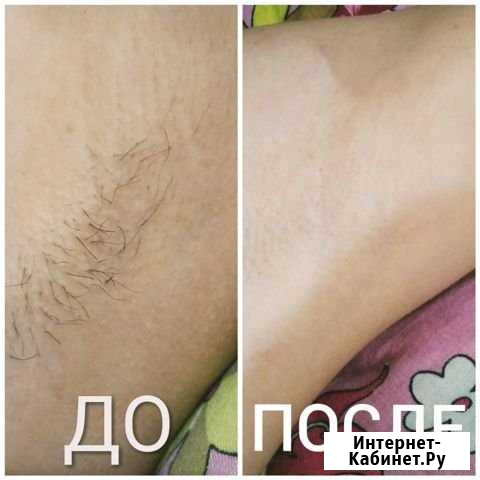 Шугаринг Сысерть - изображение 1