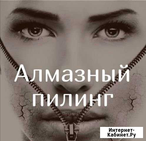 Алмазный пилинг Бузулук - изображение 1