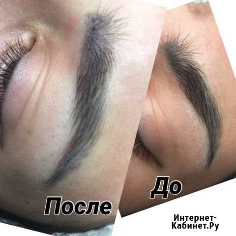 Выведение некачественного татуажа Кемерово - изображение 1