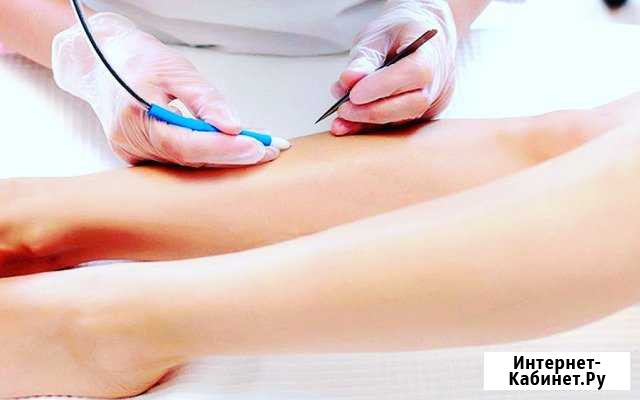 Электроэпиляция Кумертау Кумертау - изображение 1