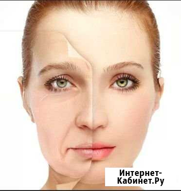 Удаление морщин, омоложение лица Уфа - изображение 1