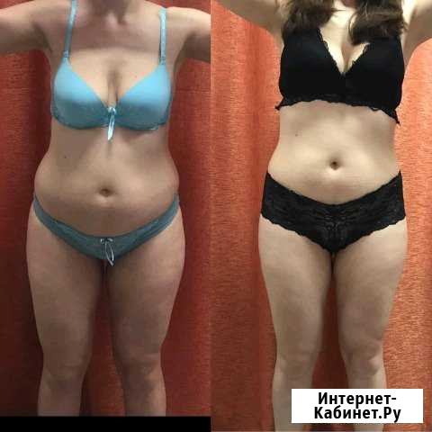 Антицеллюлитный комплекс Иркутск - изображение 1