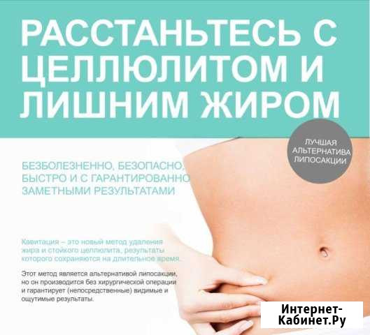 Кавитация, RF лифтинг тела, вакуумный лимфодренаж Тула - изображение 1
